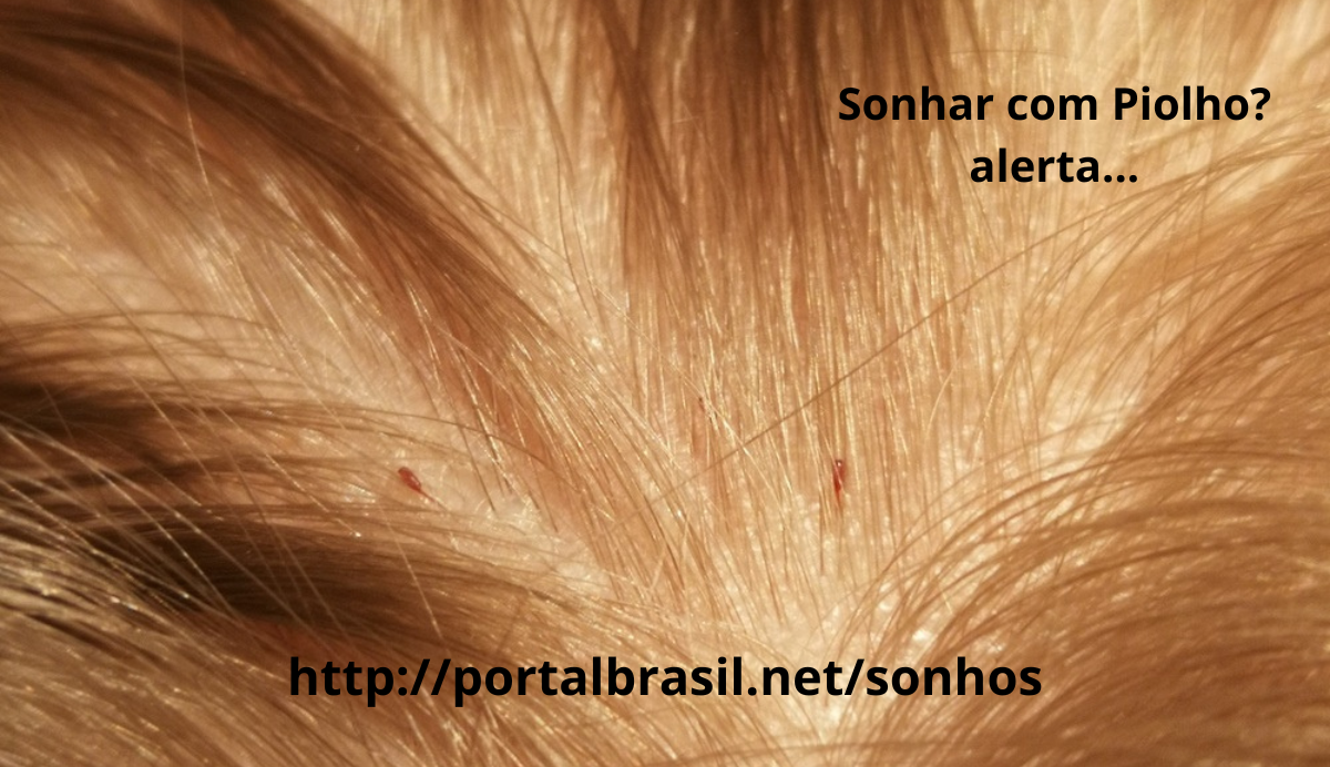 Sonhar com Piolho têm Alguns Significados. Atenção Cuidado!