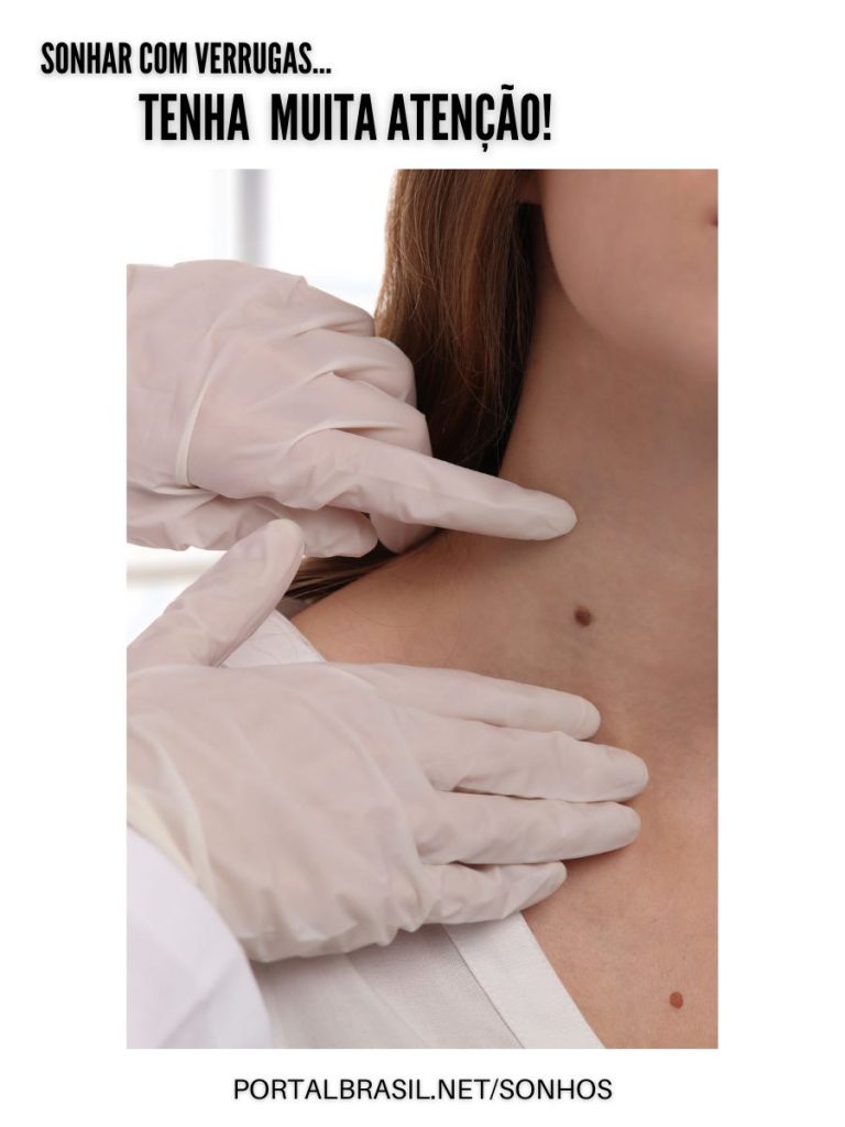 Sonhar com verrugas no corpo significa, principalmente, que alguém vai quebrar sua confiança.